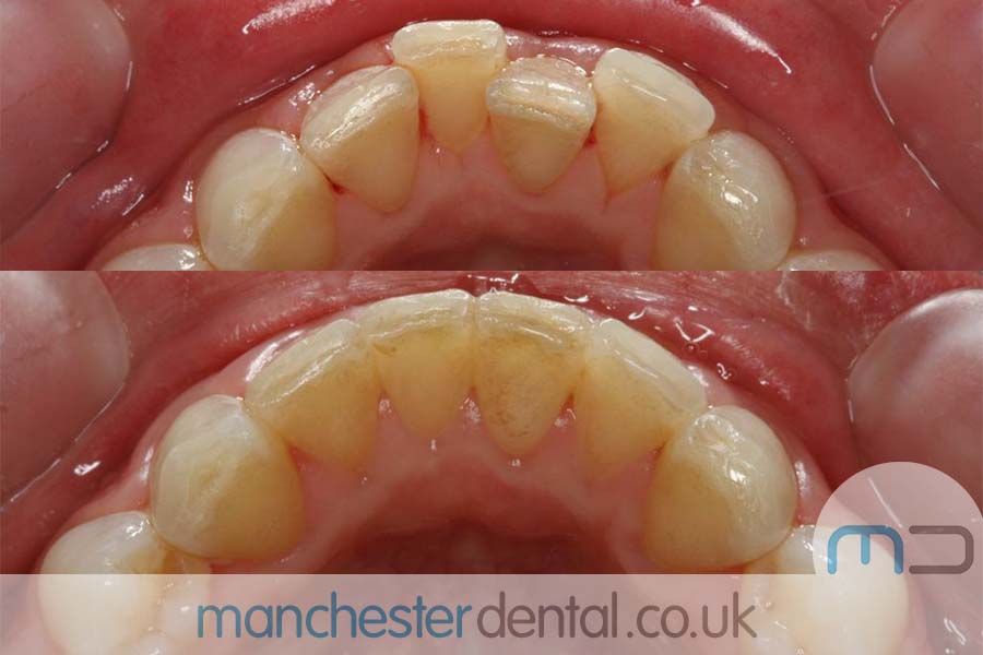 manchester dental orthodontics work gallery (6) manchester dental orthodontics work gallery (6)