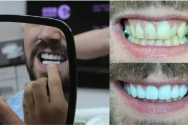 manchester dental teeth surgery