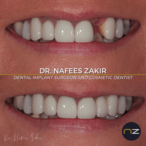 manchester dental work gallery (10) manchester dental work gallery (10)