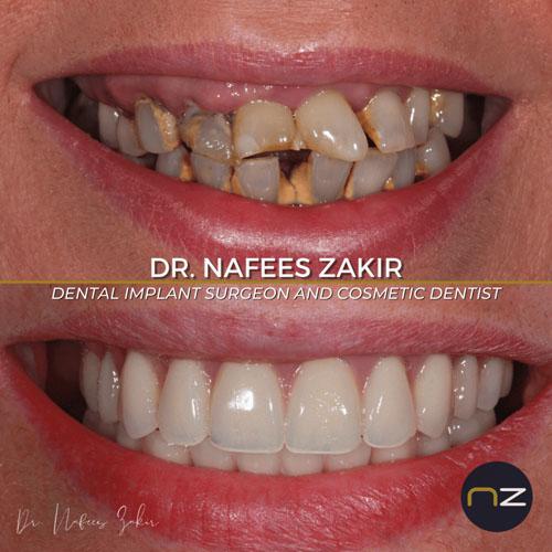 manchester dental work gallery (14) manchester dental work gallery (14)