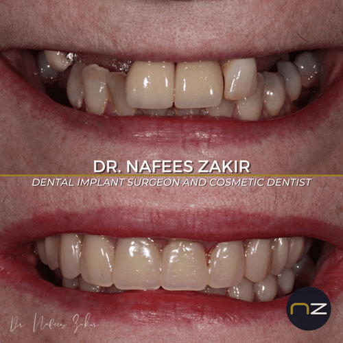 manchester dental work gallery (4) manchester dental work gallery (4)