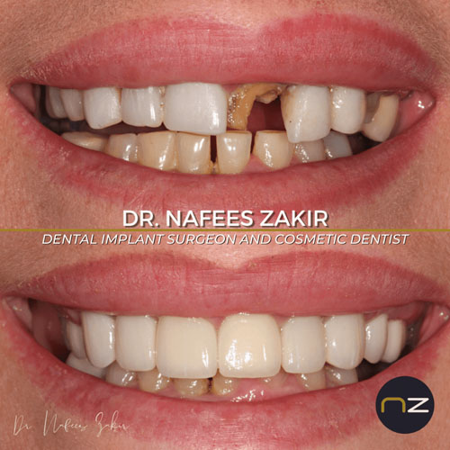 manchester dental work gallery (5) manchester dental work gallery (5)