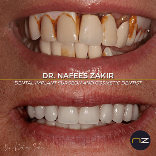 manchester dental work gallery (7) manchester dental work gallery (7)