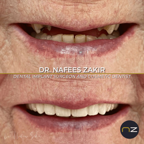 manchester dental work gallery (9) manchester dental work gallery (9)