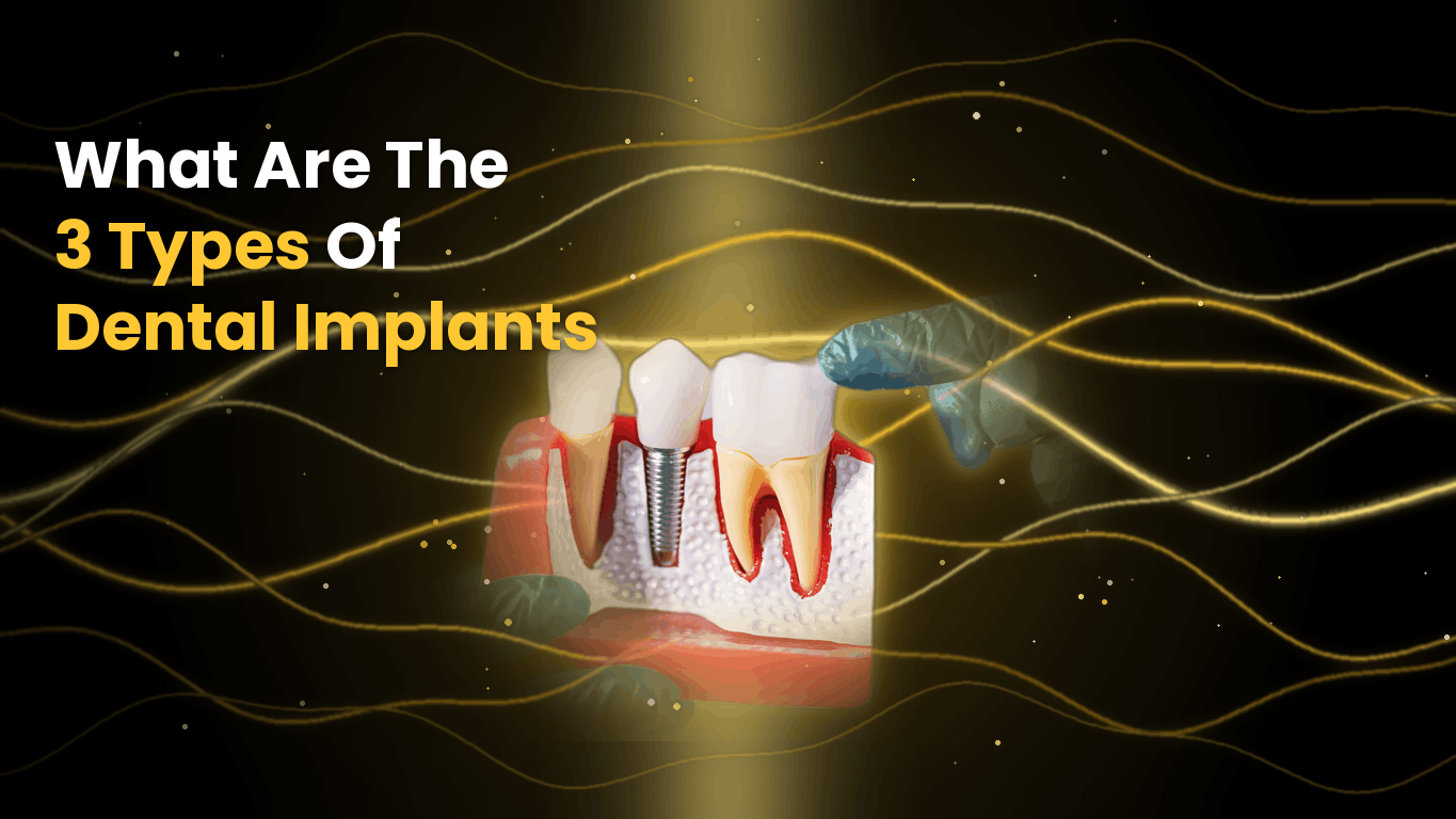 What Are The 3 Types of Dental Implants?