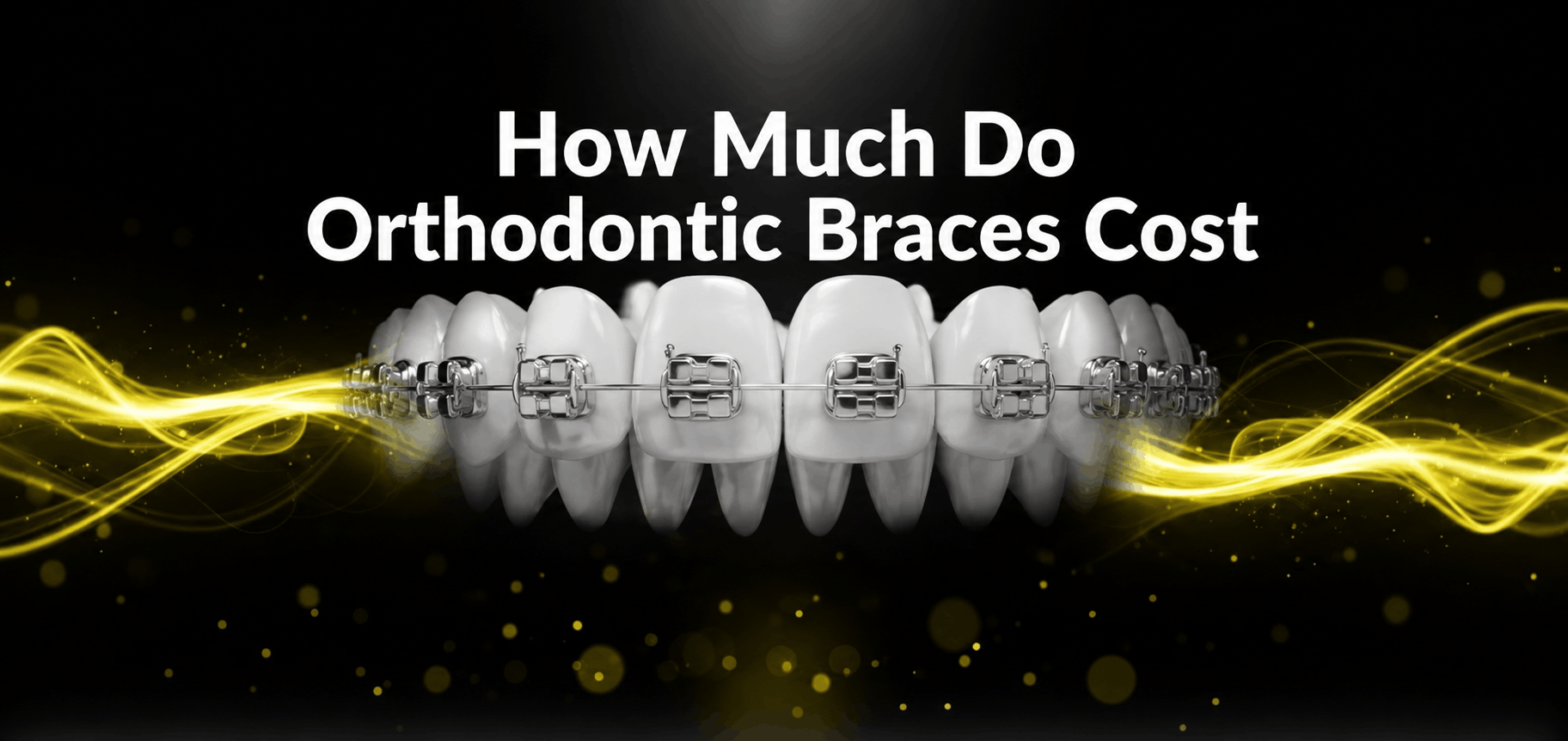 How Much Do Orthodontic Braces Cost in Manchester How Much Do Orthodontic Braces Cost in Manchester